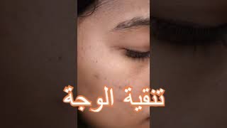 تنقية الوجه بالفوتوشوب | How to remove acnes (Photoshop)