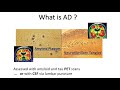 The Past, Present and Future of Brain Imaging Alzheimer's Disease  Sterling Johnson