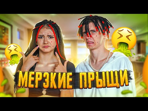ЧТО произошло С ЛИЦОМ?..😳Liza Nice