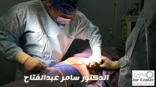 Male Breast Reduction Surgery second degree