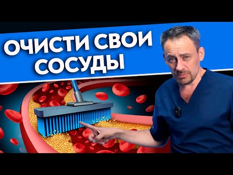 Скажи НЕТ заболеваниям сосудов! 5 простых способов очистить сосуды без таблеток