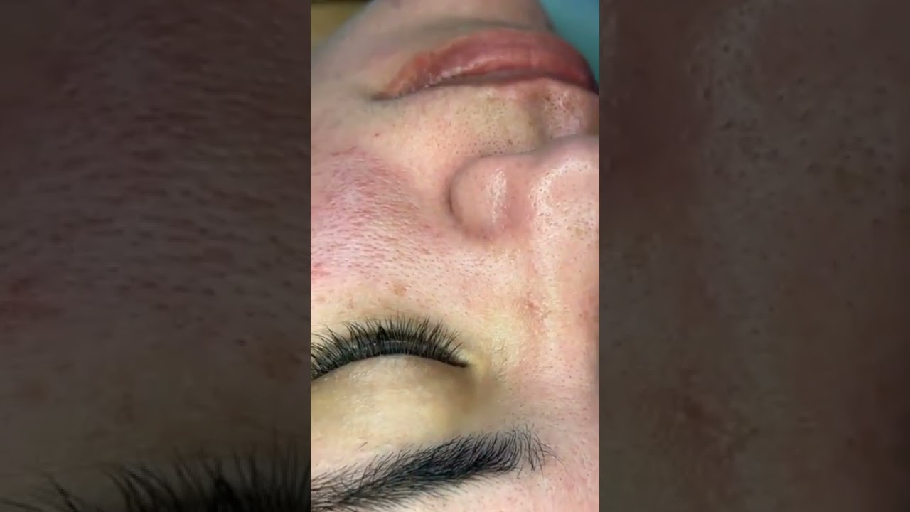 Limpieza facial profunda 🧖‍♀️