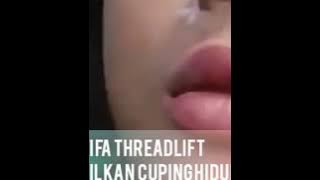 TARIK BENANG BIKIN CUPING HIDUNG KECIL