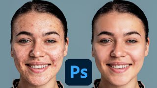 Professional SkinRetouching Method - Best Photoshop tutorial for Beginners