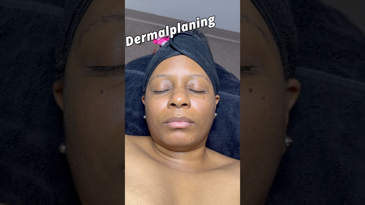 Dermaplaning is a must to try at DiamondKeys Beauty Spa #skincare #dermaplaning #facial #locjourney