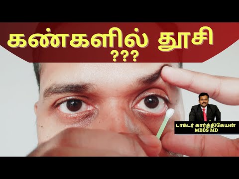 How to remove dust and clean the eyes in tamil by doctor karthikeyan