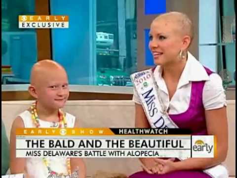 Kayla Martell Crowned Bald Miss Delaware