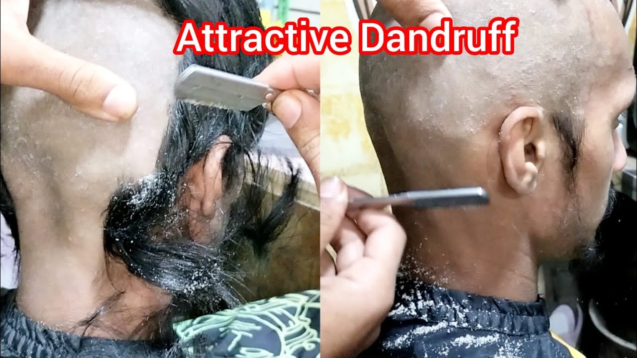 Head Shave How to full Dandruff Head Shave 2024 Bald Head Shave