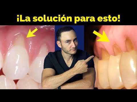 Video: 4 formas de triturar las pastillas