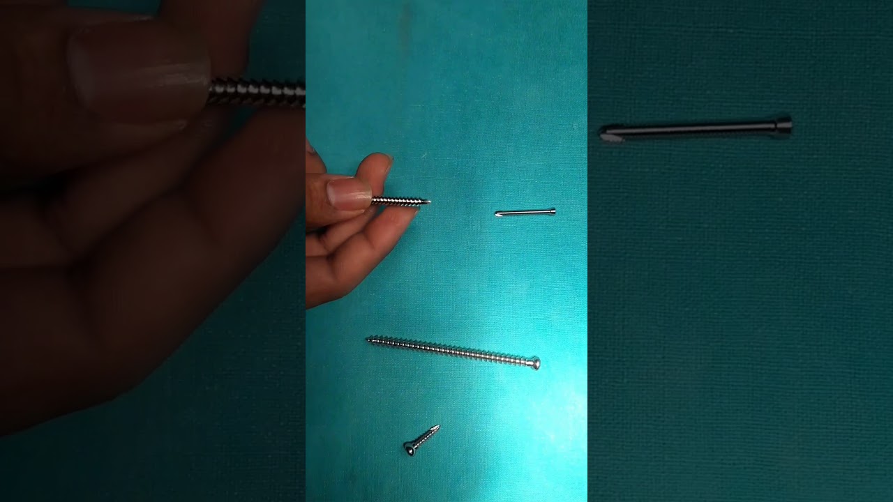 Types Of Screws In Orthopedics By Dr Darshan Patel YouTube Types Of Screws In Orthopedics By Dr Darshan Patel YouTube