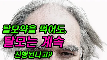 ENG 모발이식 탈모약을 먹어도 탈모가 진행된다고 Hair Loss Progresses Even If You Take Hair Loss Pills