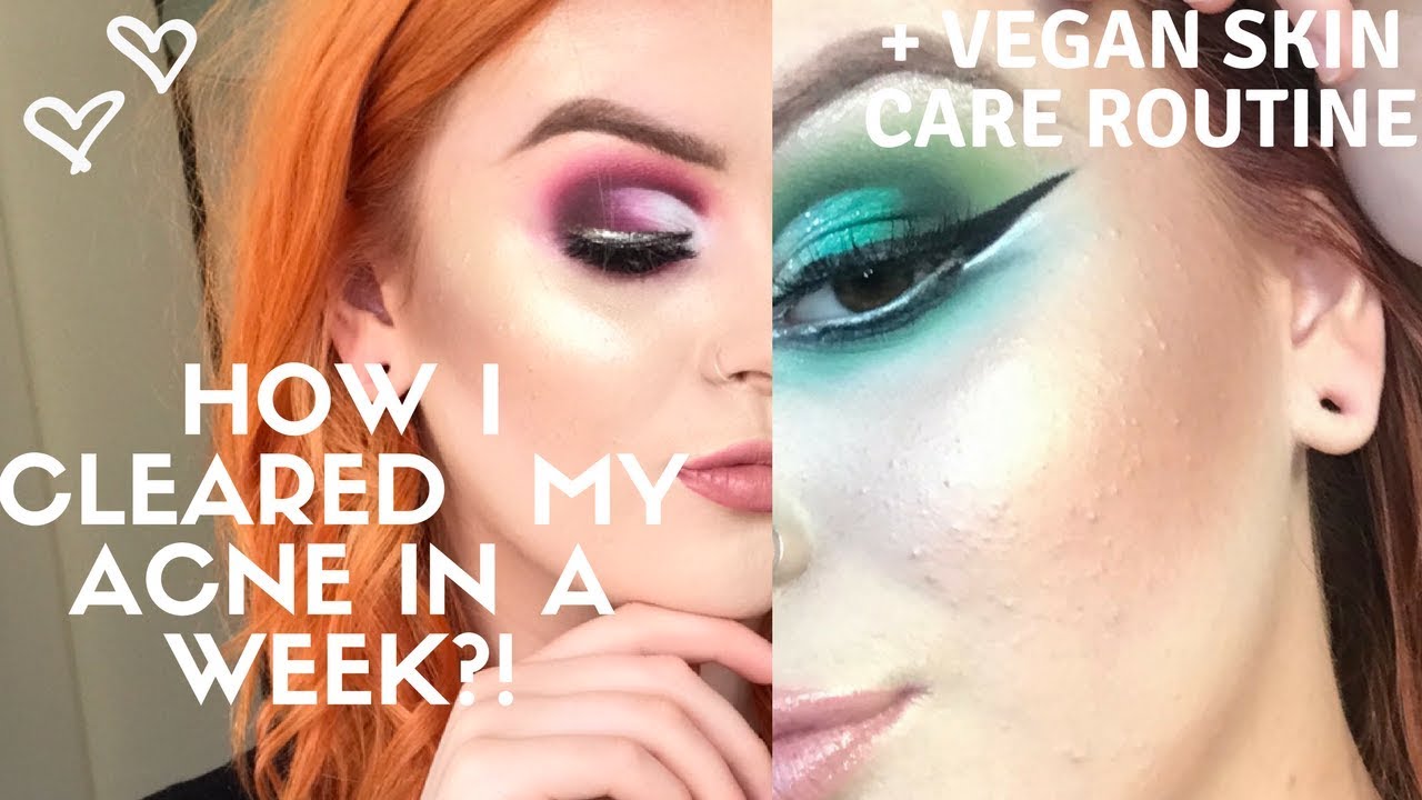 HOW I CLEARED MY ACNE IN A WEEK - MIRACLE PRODUCT! + VEGAN SKIN CARE ROUTINE - YouTube