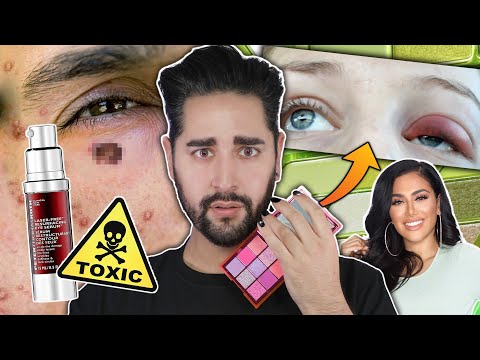 The Eye Cream That Burnt A Hole Through Peoples Skin?! Eye Cream Lawsuit - When Beauty Turns Ugly