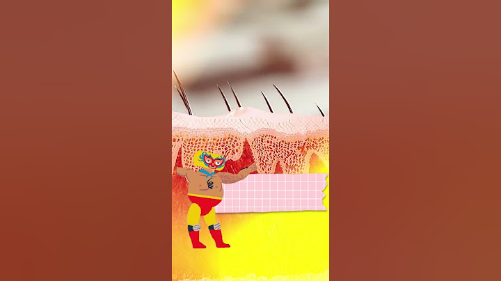 Cómo quitarse una grapa del dedo sin lastimarse 😖📎