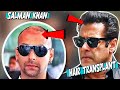 Hair Transplant Result Of Salman Khan सलमान खान के बालों का राज़