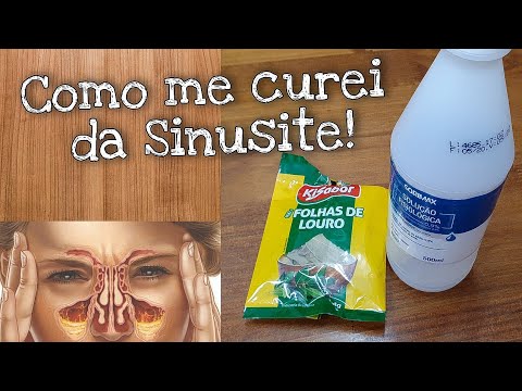 A cura natural para SINUSITE/ Vídeo explicativo!!