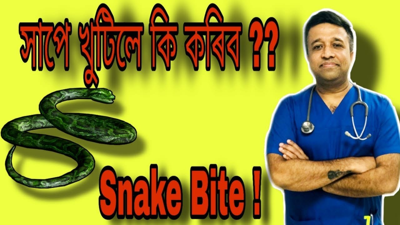 Что делать и чего не делать, если вас укусила змея!! #УкусЗмеи #Devottom #Devottom