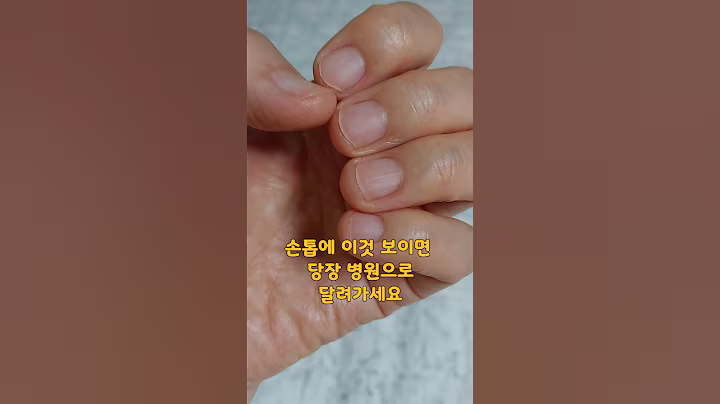 손톱이 알려주는 우리 몸의 이상신호 3가지,절대 그냥 넘어가지 마세요(음원출처:생생정보TV)#건강상식 #건강정보 #건강최고 #손톱관리 #손톱 #귀여운강아지 #반려견