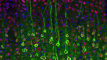 Lecture 5: Optical Imaging of Brains