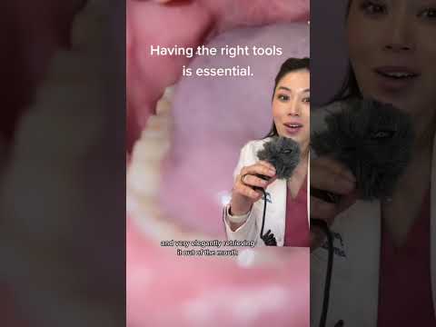 Big tonsil stone removal! #tonsilstones #tonsils #throat #denrist #tonsilitis #tonsilremoval