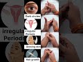 Hand Exercise For Irregular Periods, Dark Circles, Glowing Skin, Hair Growth #youtubeshorts #shorts