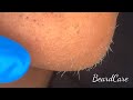 #beard #satisfying #caring #entertaining #soothing #plucking 