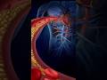LDL and HDL Cholesterol/Good and Bad Cholesterol/ Cholesterol symptoms#cholesterol #badcholesterol