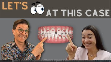 Hoe stel ik een Invisalign ClinCheck-behandelplan op?