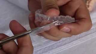 Como fazer moldeira para clareamento dental. Londrina-PR screenshot 2
