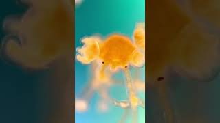 RARE find - The WORLDS SMALLEST JELLYFISH in a single drop of ocean water!