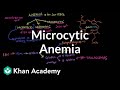 Microcytic anemia | Hematologic System Diseases | NCLEX-RN | Khan Academy