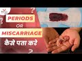    periods   miscarriage   miscarriage blood color   symptoms in pregnancy  mylo
