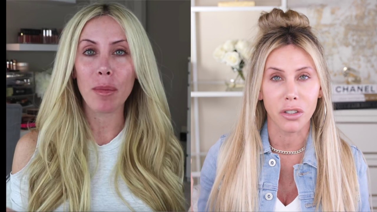 The REAL CURE to Your Skin Condition & How I 