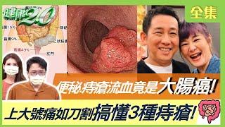 天天排便不代表沒宿便便秘、痔瘡流血竟是大腸癌達人獨門清腸排毒法上大號痛如刀割 搞懂3種痔瘡中醫4帖教你對付便秘痔瘡 健康2.0 20220814 (完整版)