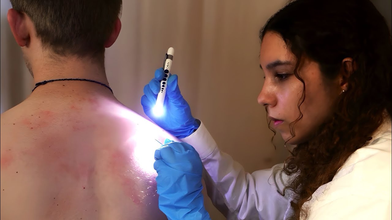 ASMR Longest Back Assessment - Skin Check, Skin Pulling, Pen light (Unintentional Style)