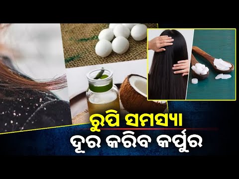 ରୁପି ସମସ୍ୟା ଯୋଗୁ ଚିନ୍ତିତ କି ? ଏହି ଉପାୟରେ କେଶରେ ଲଗାନ୍ତୁ କର୍ପୁର ||Knews Odisha