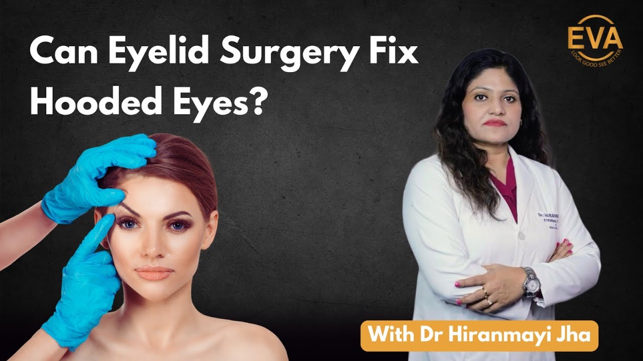 #hoodedeyes #eyelidsurgery#drhiranmayijha #blepharoplastysurgery #eternavisionandaesthetics