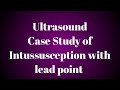 Ultrasound case study of intussusception with lead point