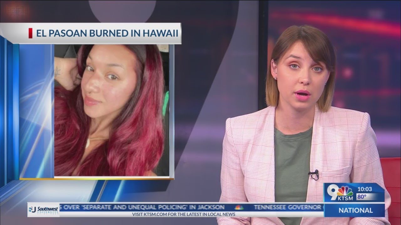 El Paso woman suffers severe burns after acid-like liquid thrown at her in Hawaii