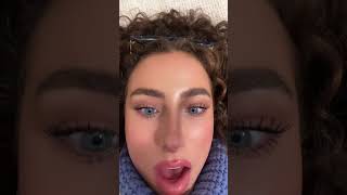 Surprise!