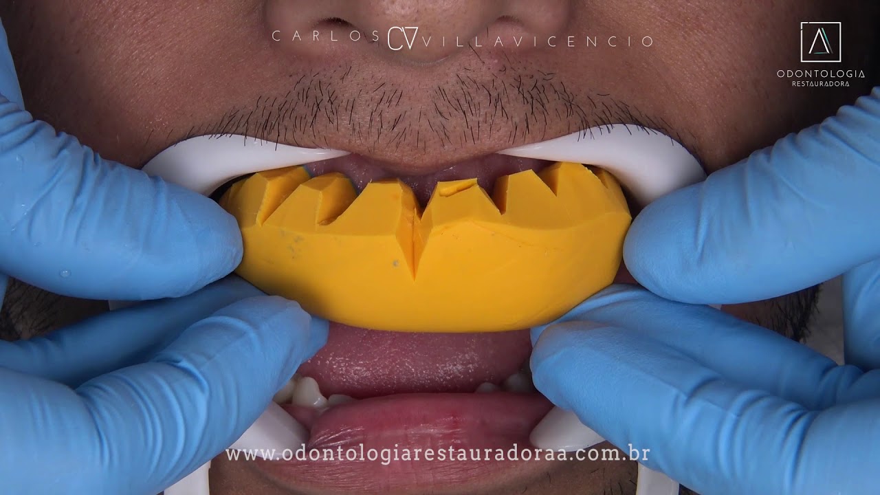 MOCK_UP-Resinas Compuestas