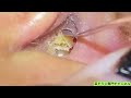 ASMR：この耳、今すぐ助けが必要だ！
