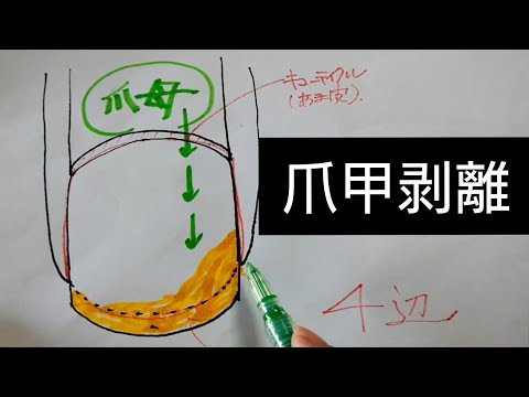 歴30年超ネイル講師が教える、爪が剥がれてくる…爪甲剥離について Vol.100