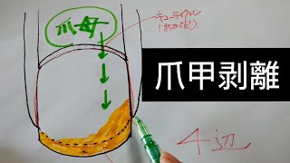 歴30年超ネイル講師が教える、爪が剥がれてくる…爪甲剥離について Vol.100