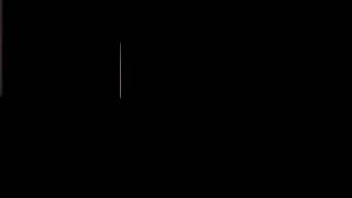 Blackpink Jisooya Yapılan Haksızlıklar