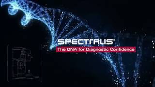 AutoRescan | SPECTRALIS