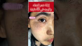 تخلصي من الشعر الزائد في الوجه طبيعيا☝️ ازالة_شعر_الوجه اسرع_خلطه_مجربة skincare