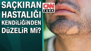 Saçkıran hastalığı kendiliğinden düzelir mi?