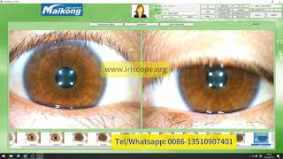 How to user install and uninstall maikong iridology software German2 2024