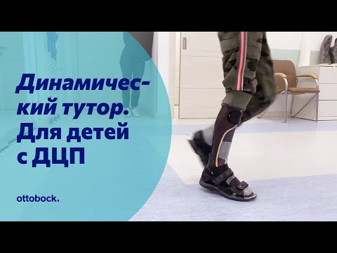 Динамический тутор при спастической диплегии у детей с ДЦП